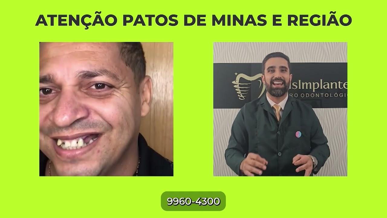 30 MINUTOS 04 10 2024